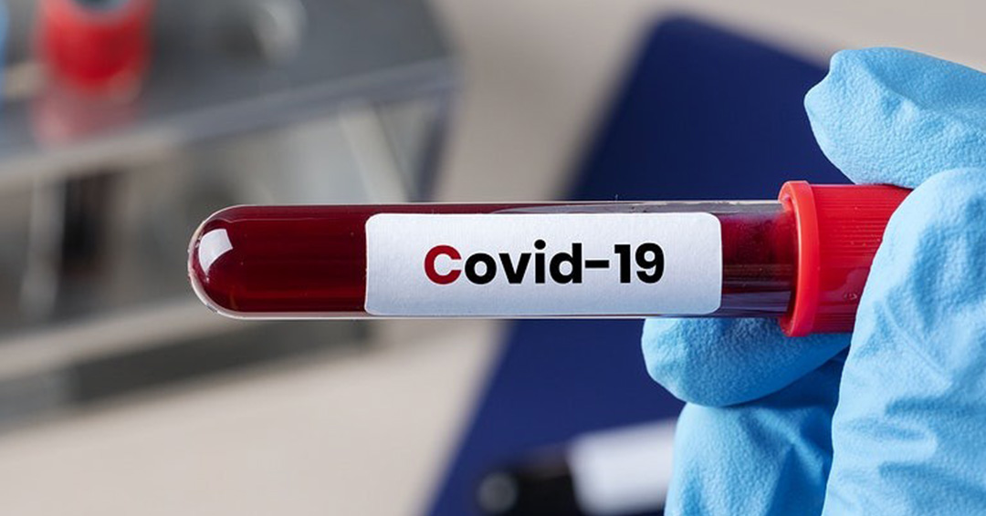 COVID-19 UPDATES: Health Ministry announces the use of plasma to treat COVID-19