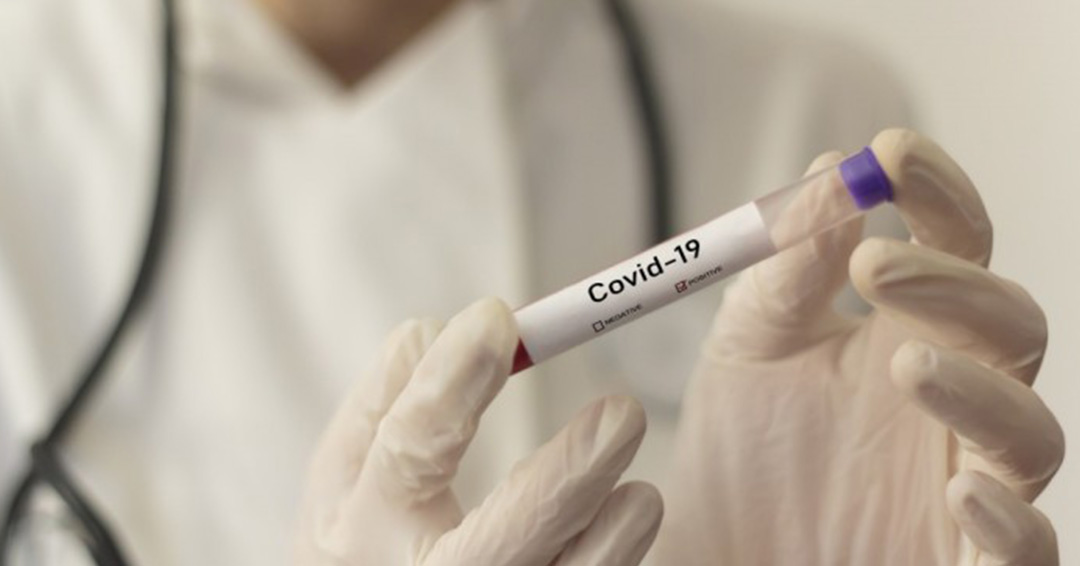 Fighting Coronavirus Together: COVID-19 Re-infection Possible - Research.