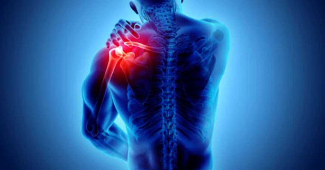 Staying Well Together: How to Relieve Muscle Pain After Working Out