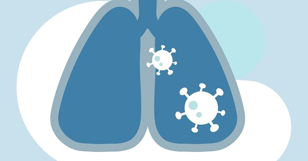 COVID-19 Updates: Doctors Say Long COVID May Affect Multiple Body Parts